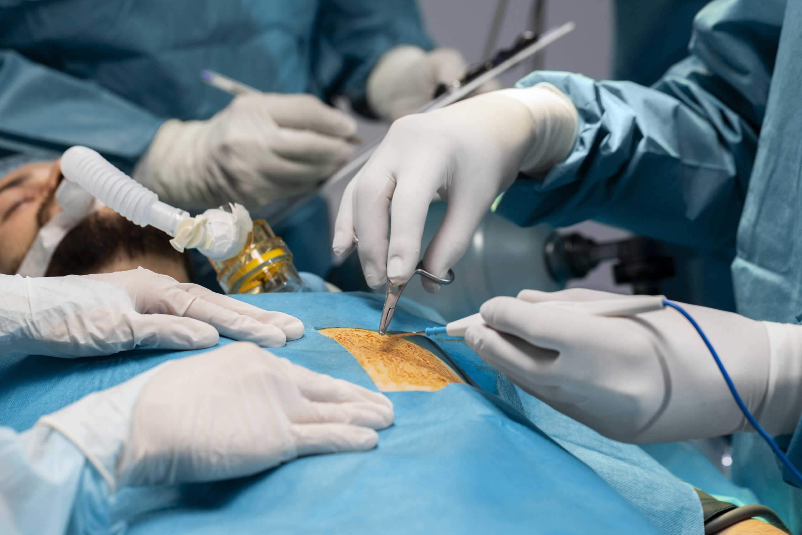 Circumcision Care
